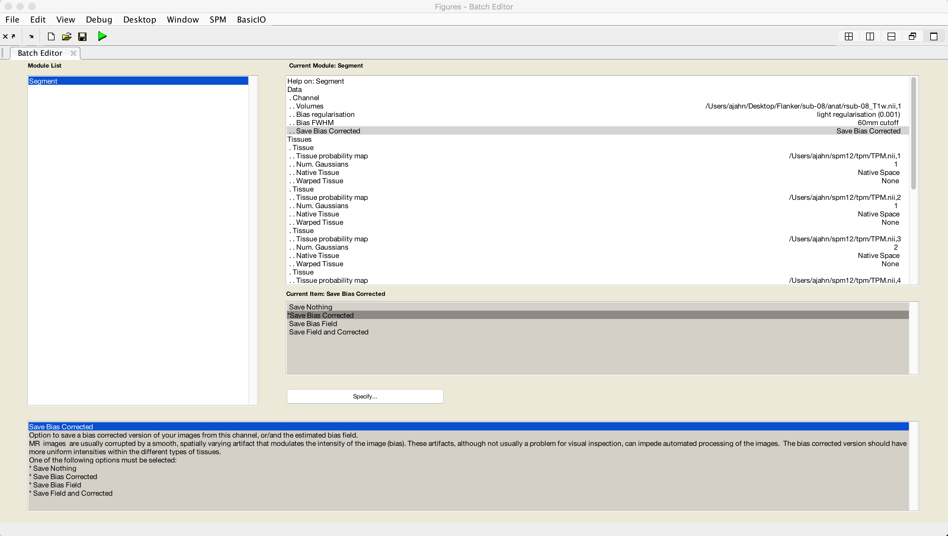 ../../../_images/04_04_Segmentation_GUI.png
