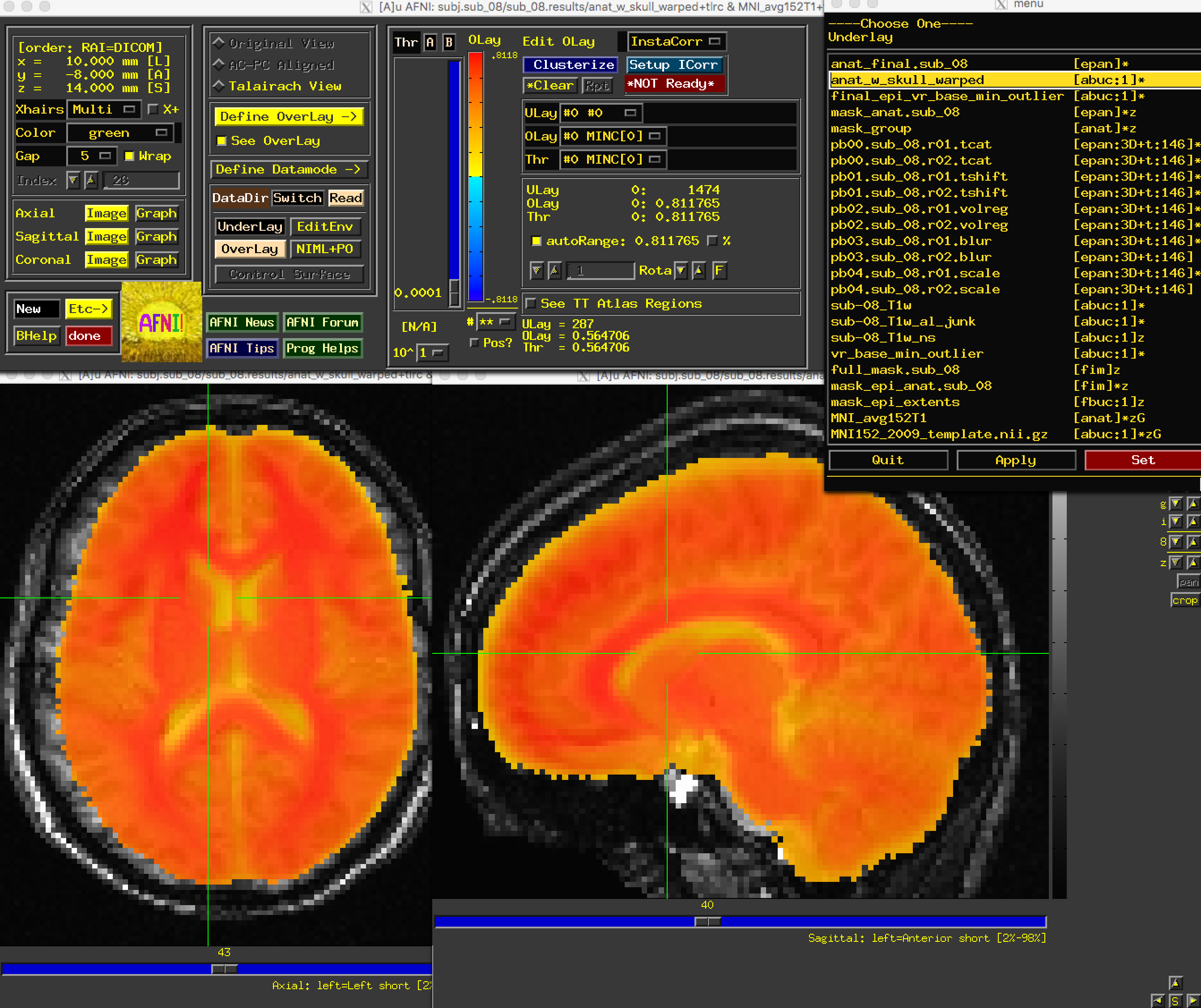 ../../../_images/04_07_Normalization_AnatWithSkull.png