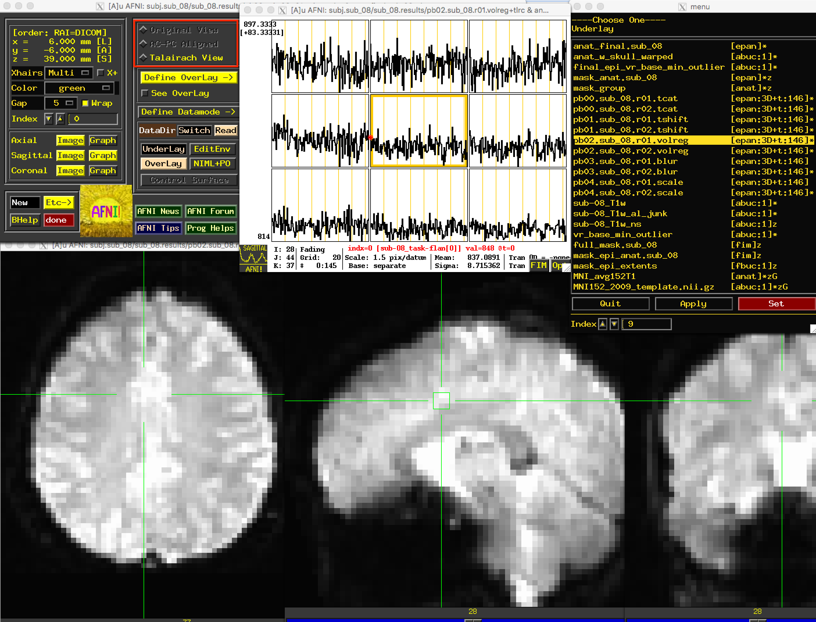 ../../../_images/04_07_Volreg_Output.png