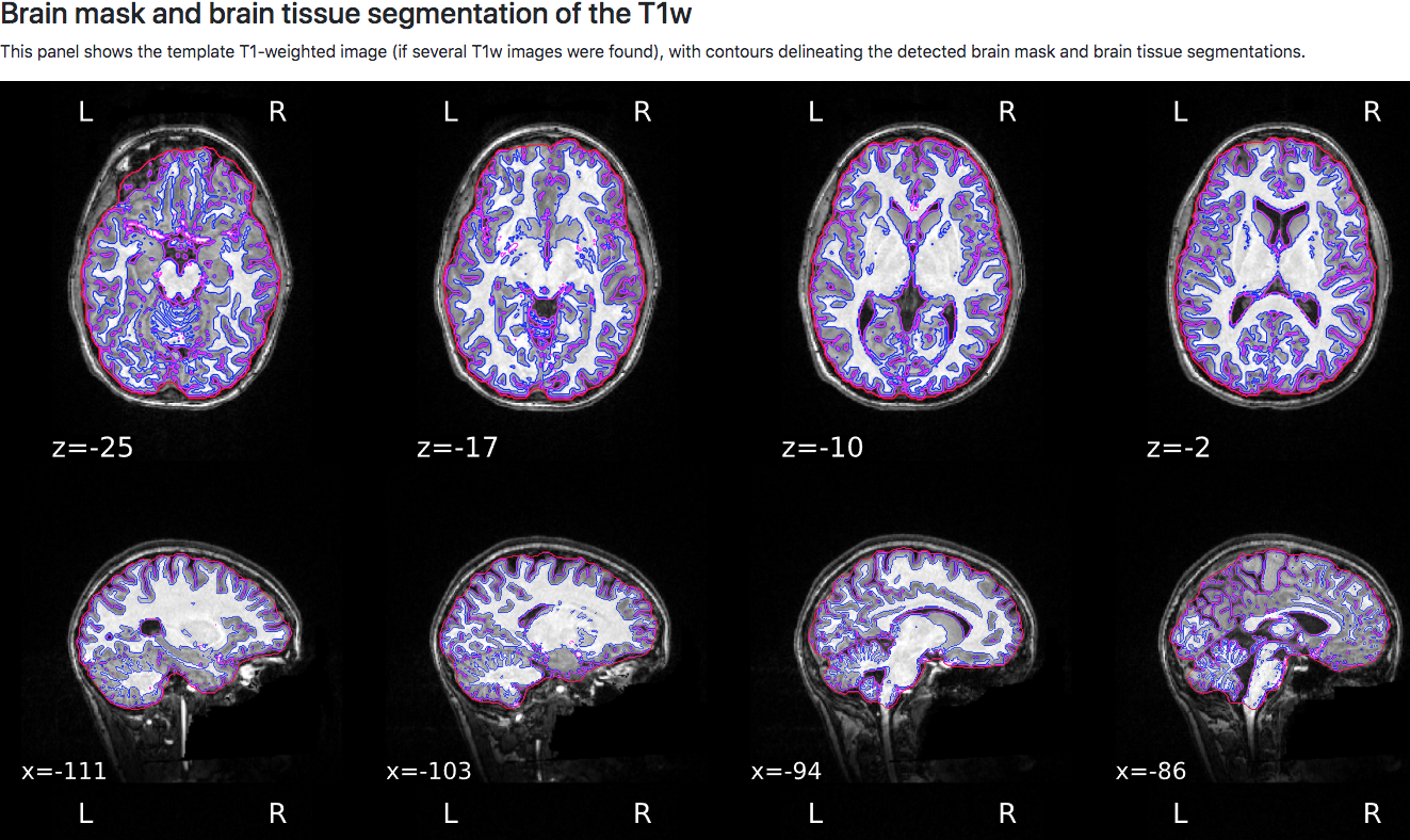 ../../_images/03_Anatomical_QA.png