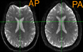 ../../_images/04_AP_PA_Comparisons1.png